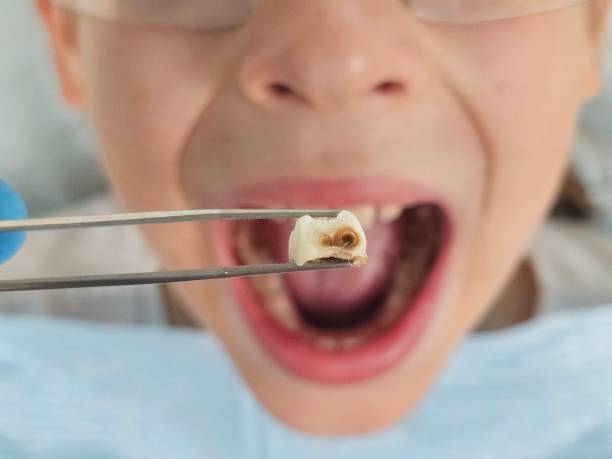 Best Pediatric Emergency Dentist in Allison, IA