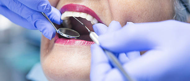 Best Urgent Care for Lost Fillings or Crowns in Allison, IA